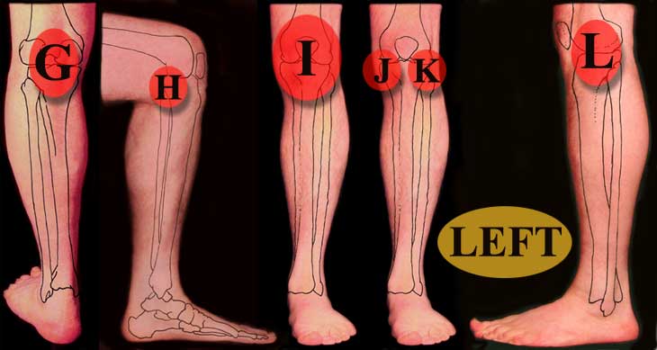 Pain in back of knee and leg muscles anatomy, high anxiety